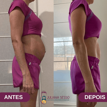 antes-depois-juliana-sesso-1.fw