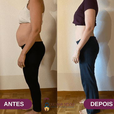 antes-depois-juliana-sesso-2.fw