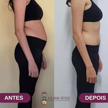 antes-depois-juliana-sesso-4.fw